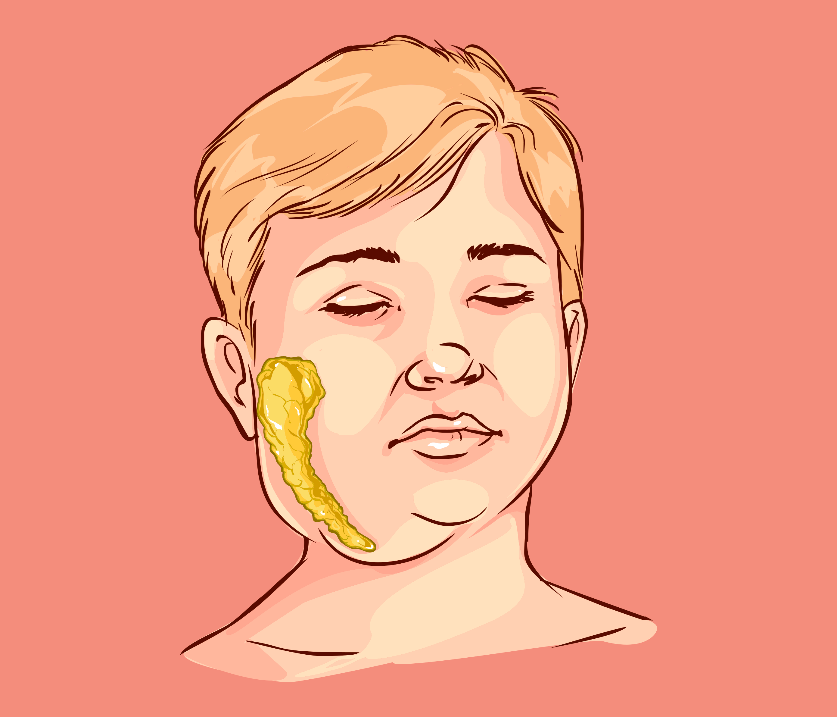 Remédios Caseiros para Aliviar a Dor da Caxumba: O Que Funciona?