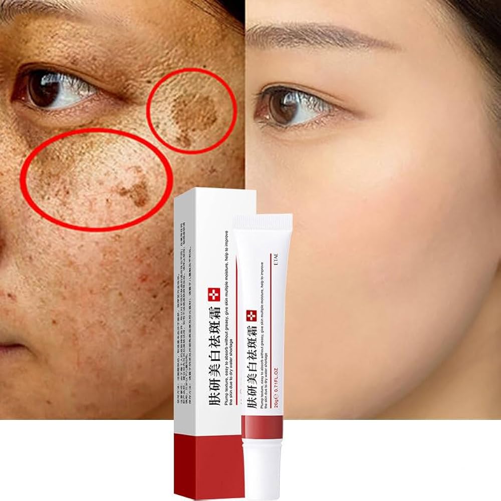 melhores séruns para melasma 2025