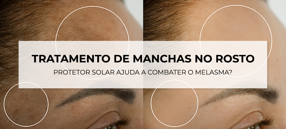 clareador facial acessível com Thiamidol