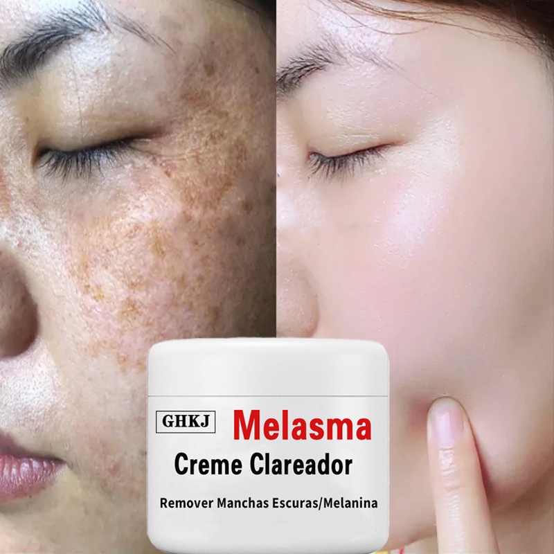 tratamento para marcas de acne e oleosidade