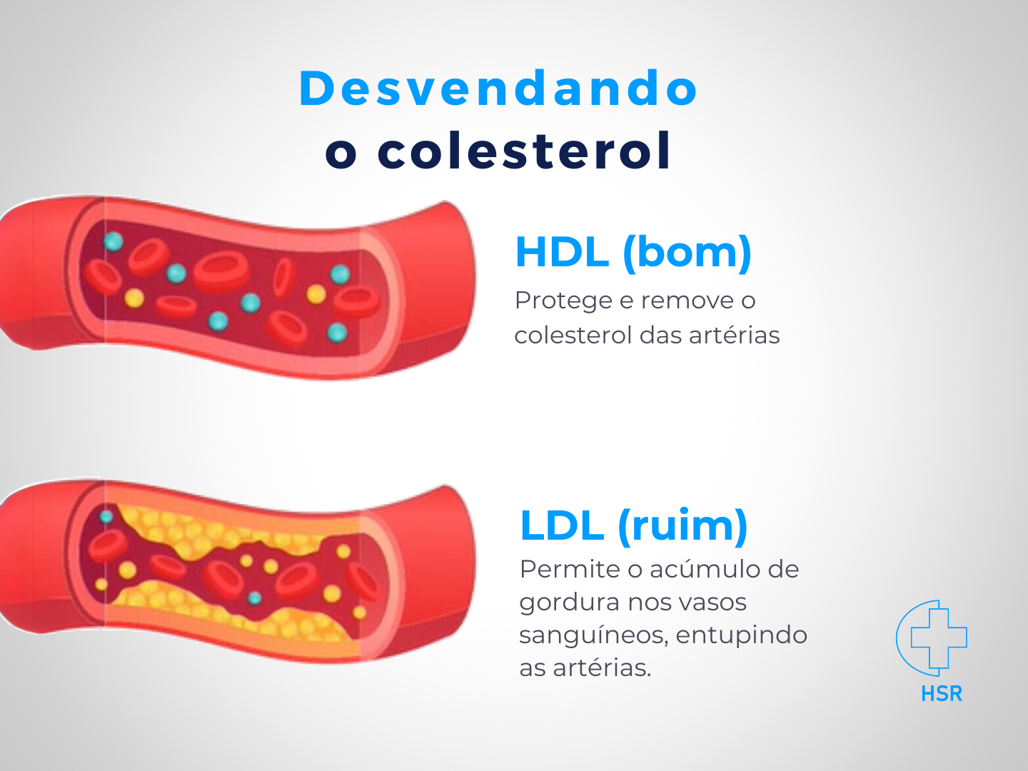 Como interpretar seu exame de colesterol: HDL
