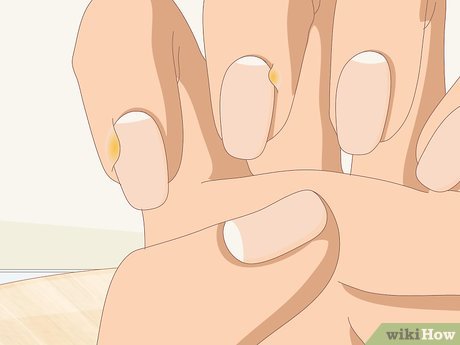 cuidados com as cutículas para não crescerem