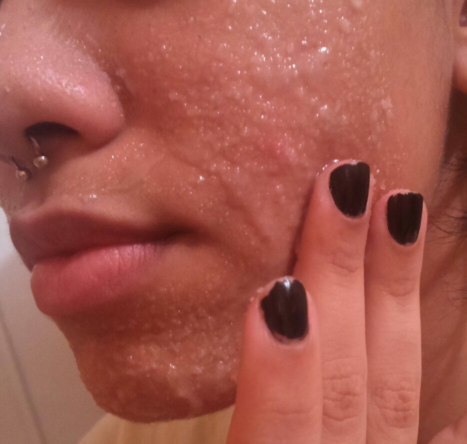 Os Melhores Esfoliantes Químicos para Cada Tipo de Pele