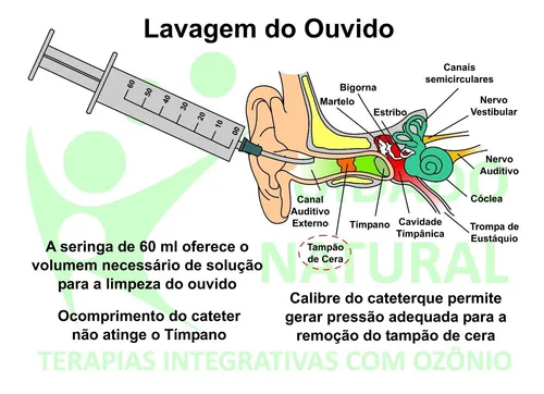 como fazer lavagem ouvido