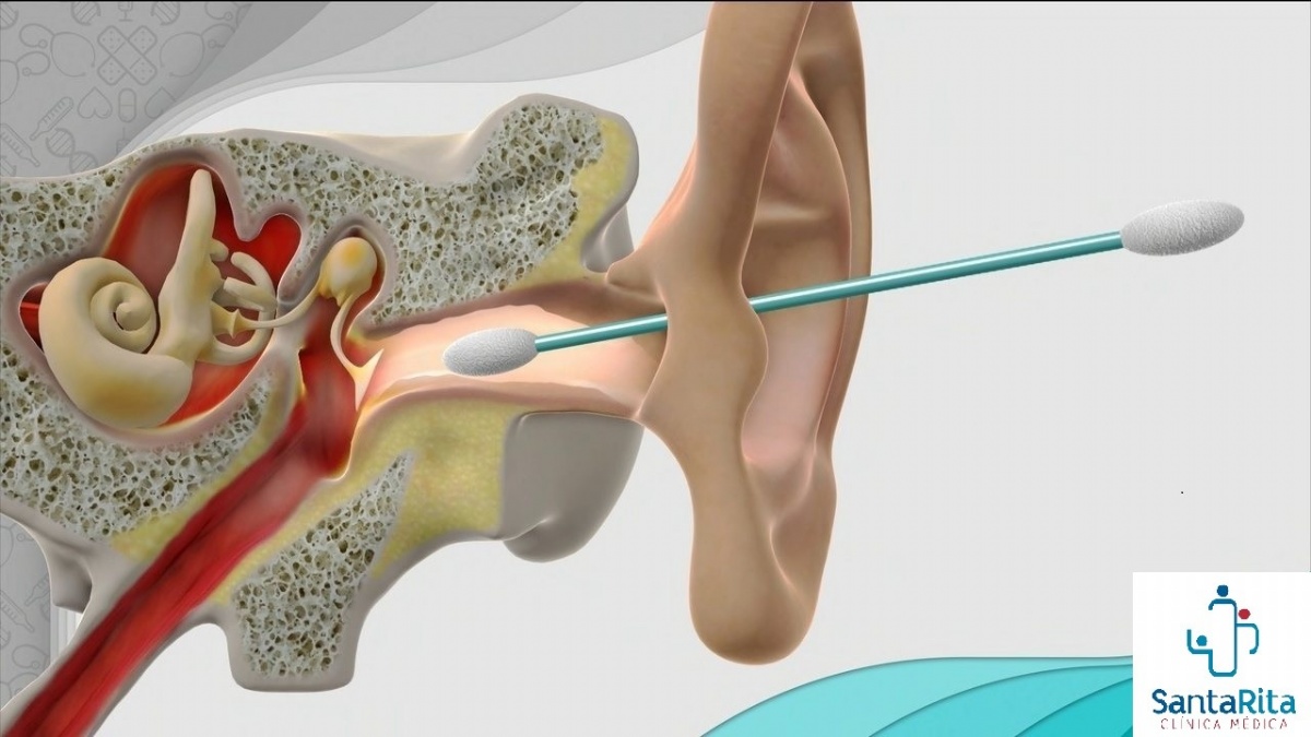 como fazer lavagem de ouvido em casa
