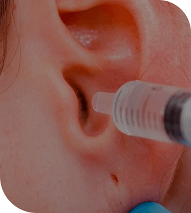 riscos da lavagem de ouvido caseira