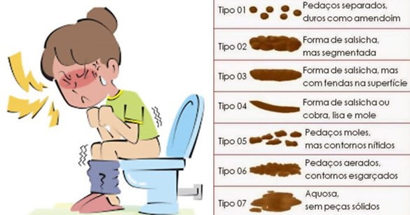 constipação crônica