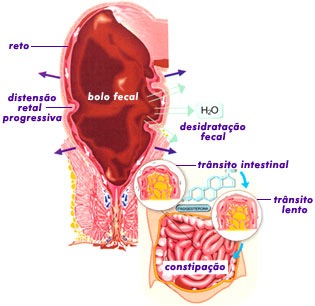 Alimentos que combatem a constipação crônica