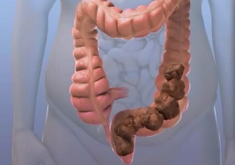 A importância da hidratação para o trânsito intestinal