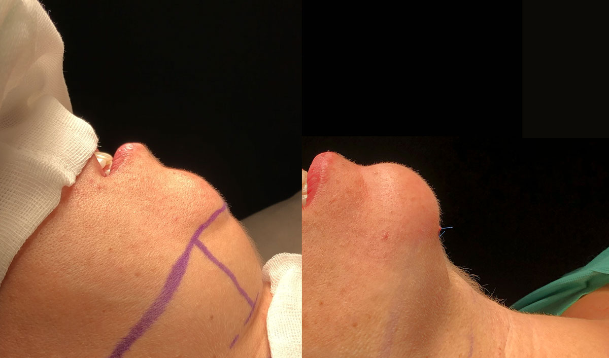 Os Melhores Contornos Cremosos e em Pó de 2024: Análise e Preços