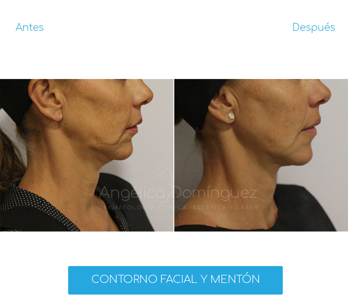 Os Melhores Contornos Cremosos e em Pó de 2024: Análise e Preços