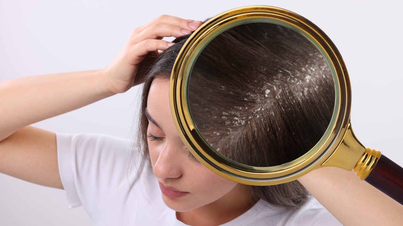 o que causa couro cabeludo com coceira e escamas