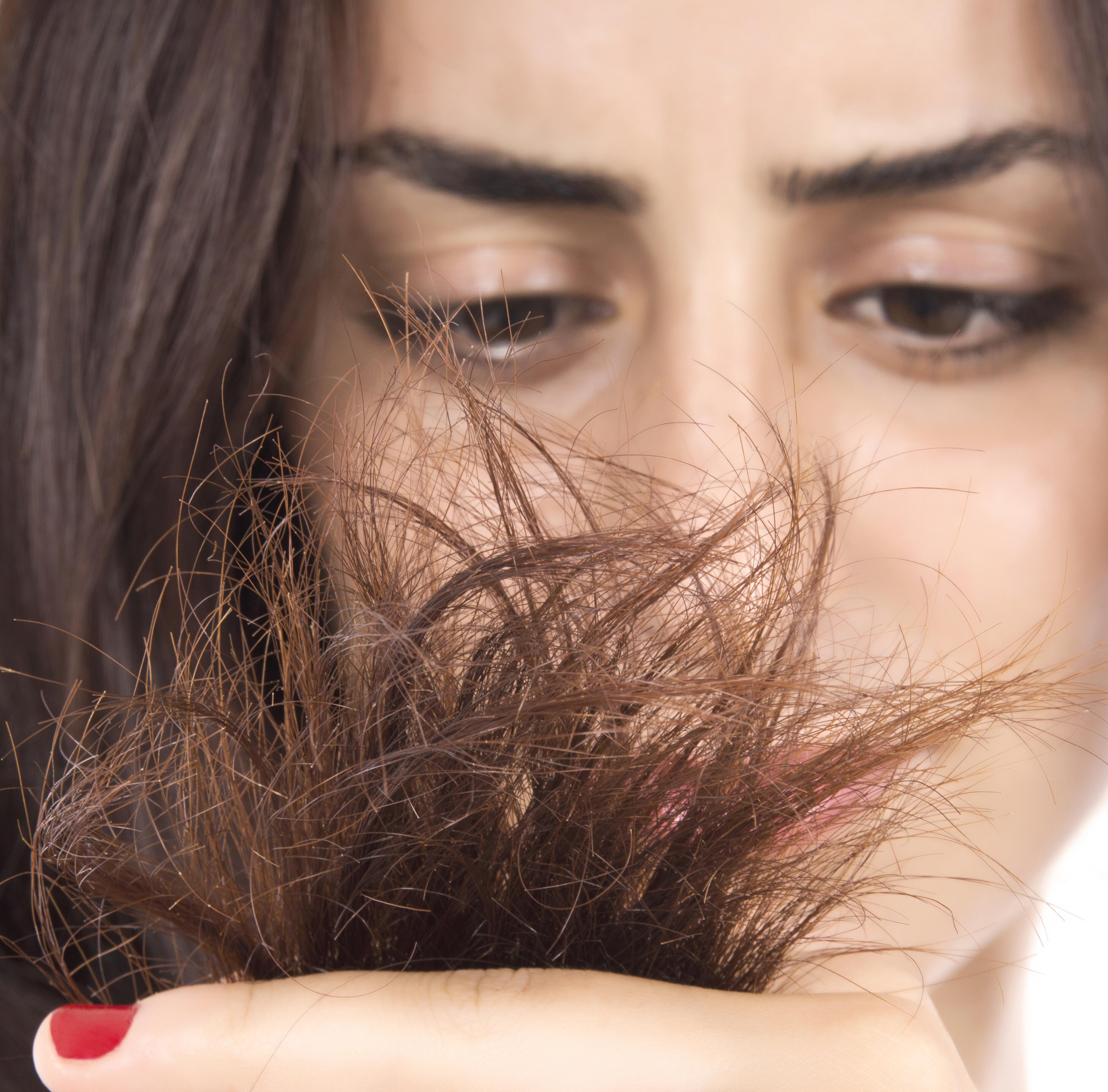 o que causa couro cabeludo com coceira e escamas