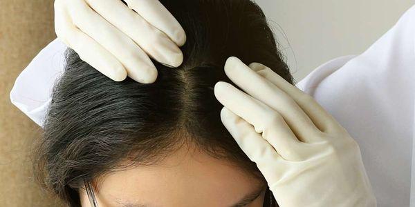 remédios caseiros para couro cabeludo seco