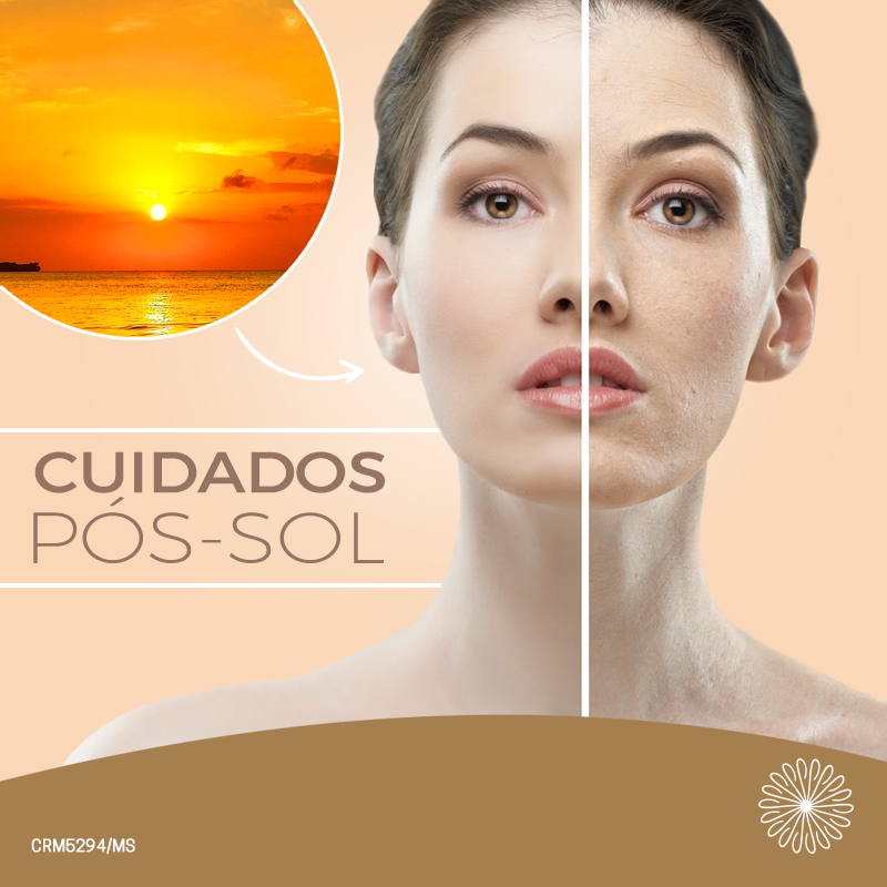 cuidados pós-sol