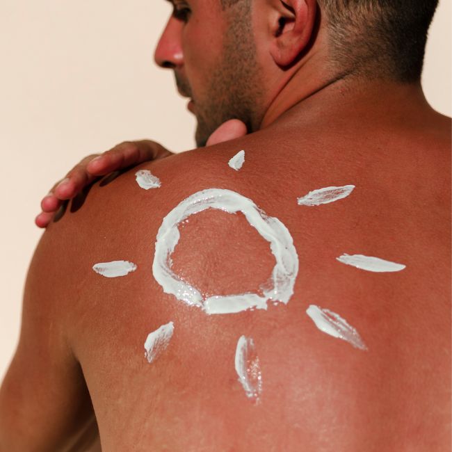 tratamento natural para pele queimada de sol