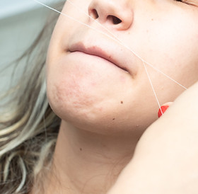 Guia Completo: Epilação de Buço com Linha em Casa