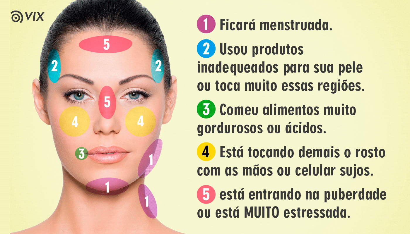 Skincare Essencial para Pele Acneica: Produtos e Rotinas
