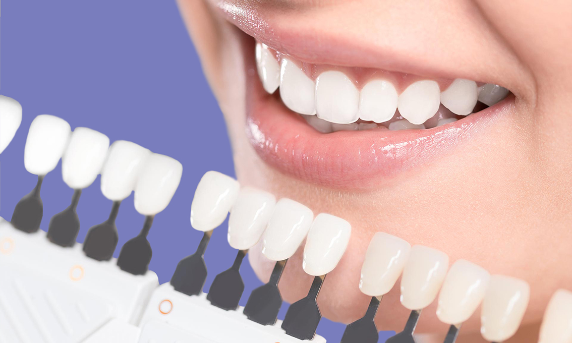 Coroas de Porcelana: A Solução Intermediária para Seu Sorriso