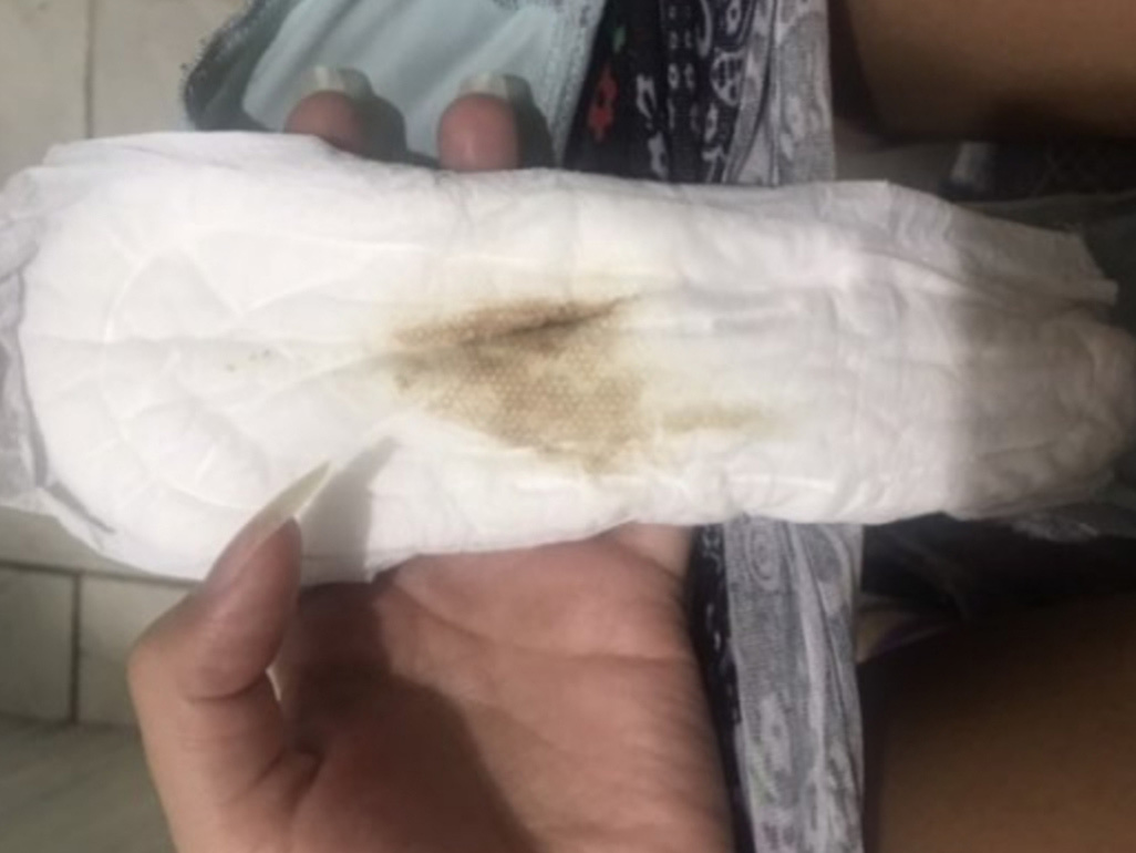 fotos de nidação no absorvente