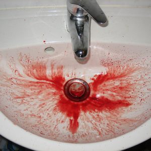 Outros sintomas de gravidez precoce além da nidação