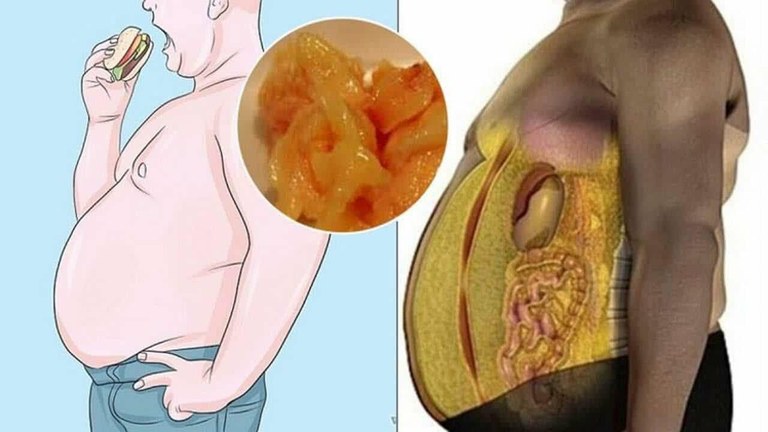 Os Melhores Exercícios para Queimar Gordura Visceral e Definir o Abdômen