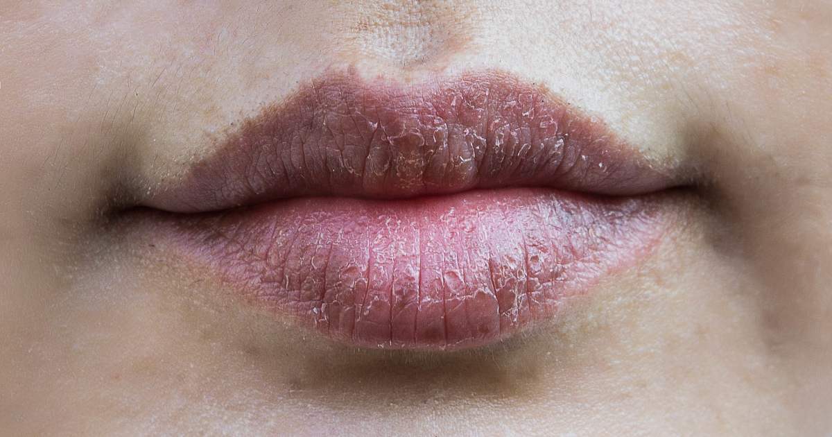 Diabetes Gestacional: Sintomas e Cuidados Essenciais