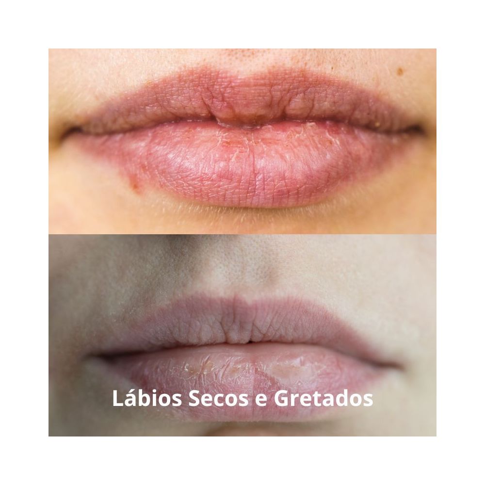 Como Aliviar a Boca Seca Durante a Gravidez: Dicas Práticas