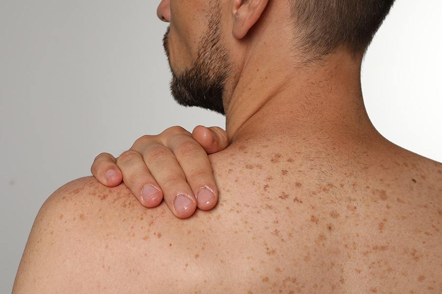 Pano Branco e Outras Condições