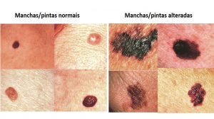 Diagnóstico e Prevenção