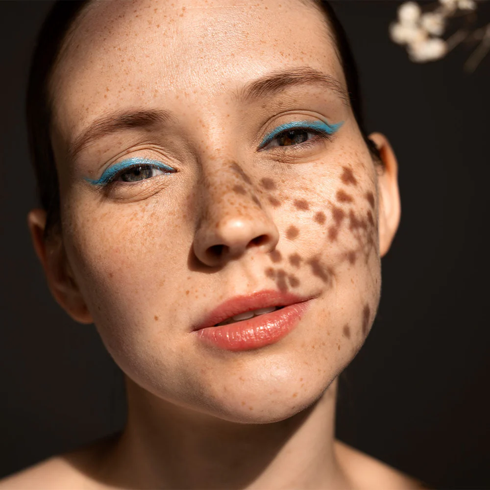 Dermatites e Alergias: Entenda as Manchas Vermelhas e Coceira na Pele