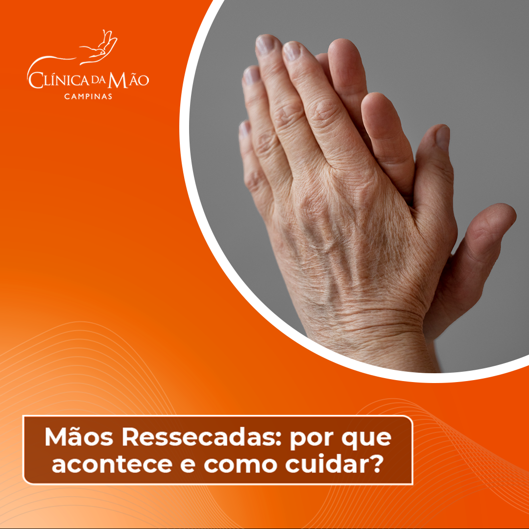 tratamento para mãos ásperas e ressecadas