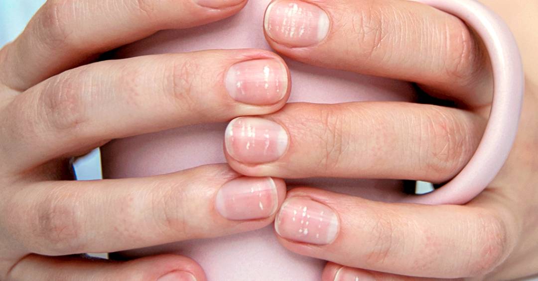 Marca D'água no Celular: iPhone vs. Samsung para Fotos de Manicure