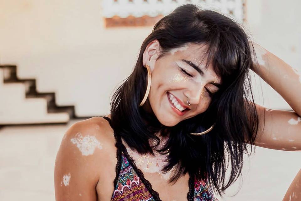 Vitiligo: Mitos e verdades sobre tratamentos