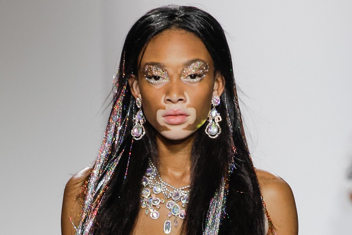 Dicas de maquiagem para vitiligo: Arte e camuflagem