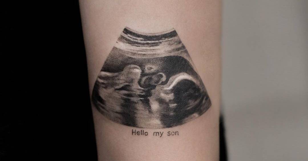 Como Lidar com as Emoções Pós-Parto: Um Guia para Pais