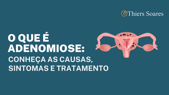 o que é adenomiose