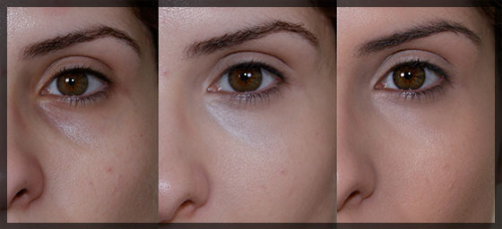 Top 5 Ativos Cosméticos Essenciais para Combater Olheiras