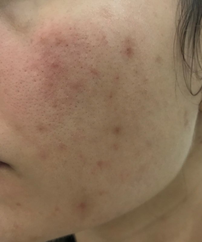 benefícios do peeling de café em casa