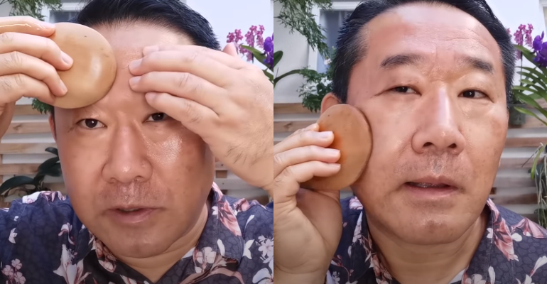 cuidados pós peeling químico caseiro