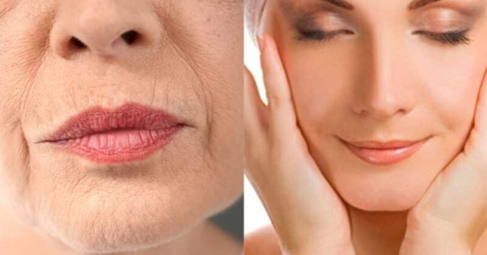 receita de peeling natural para acne