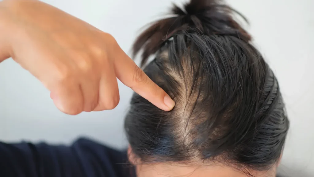 Penteados rápidos para cabelo fino e sem vida