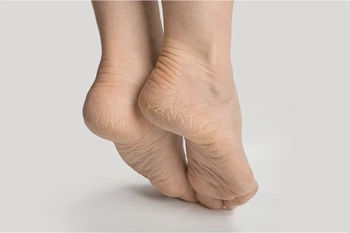 Mitos e Verdades sobre Lixar os Pés: O Que Você Precisa Saber