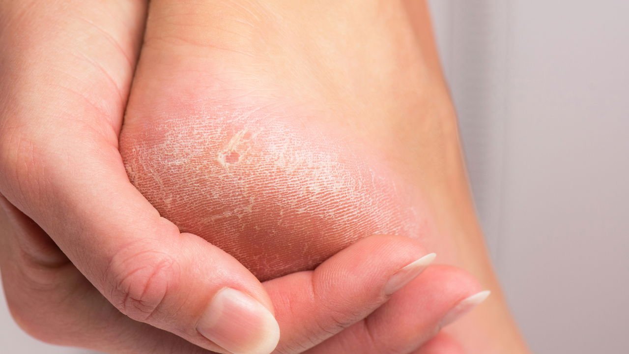 Mitos e Verdades sobre Lixar os Pés: O Que Você Precisa Saber