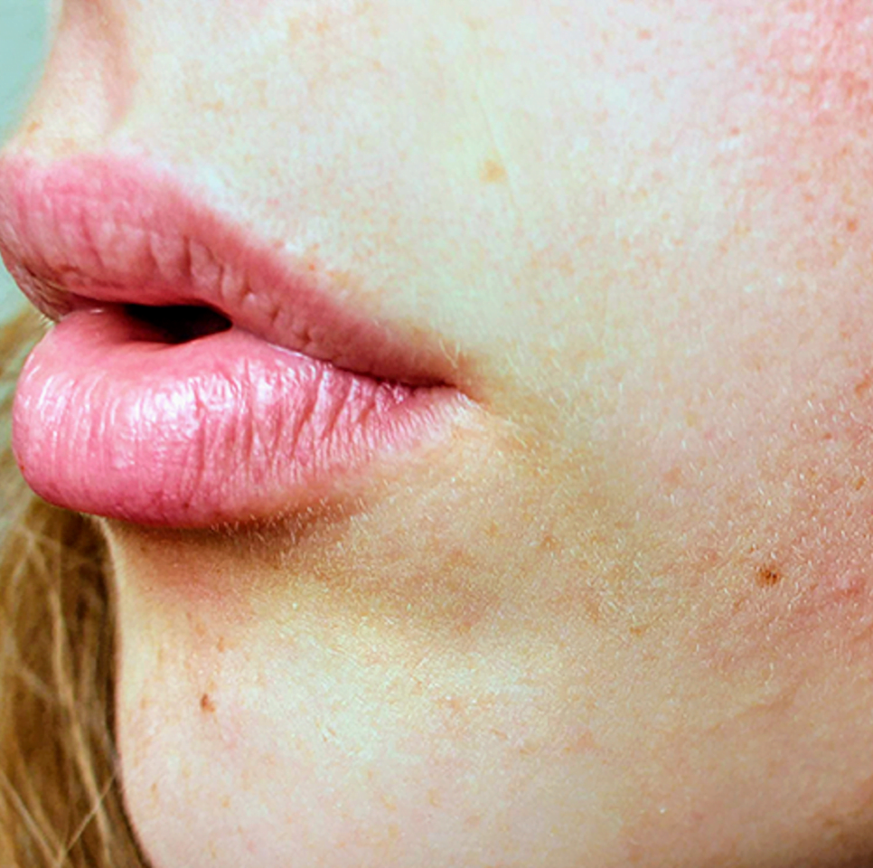 rotina de skincare poros dilatados