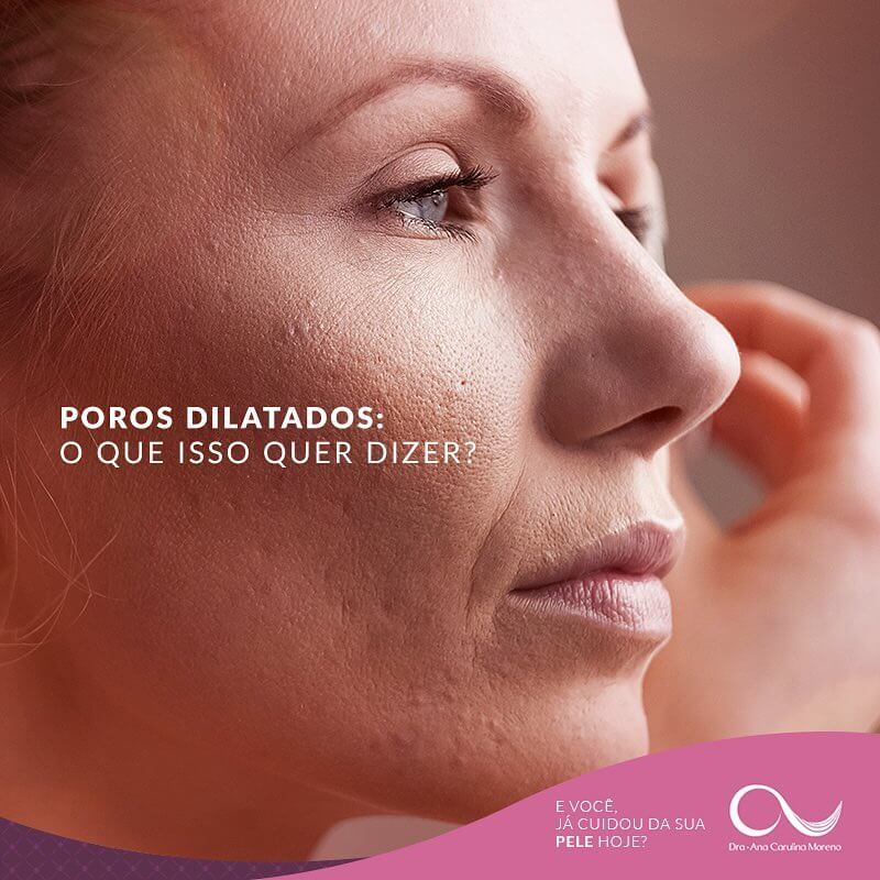 reduzir poros visíveis