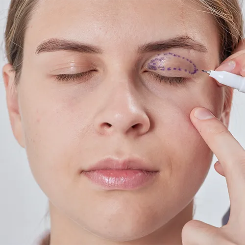 preparação de pálpebra