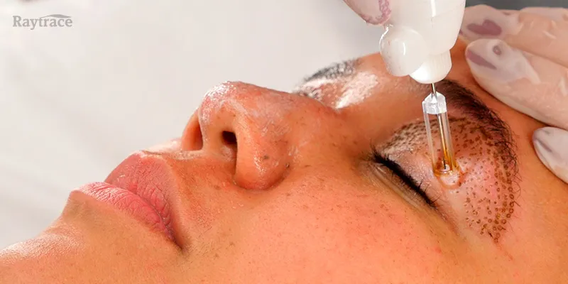 preparação de pálpebra