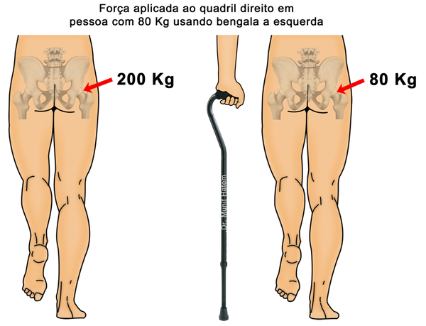 toxicidade de metais em implantes