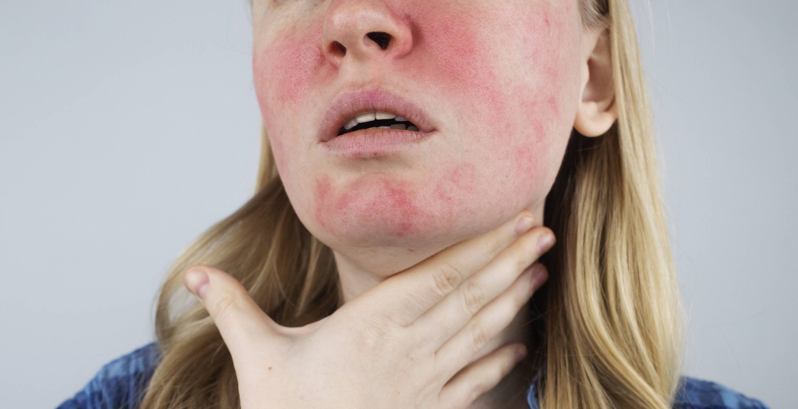 Guia Completo: Como Montar um Diário Alimentar para Rosácea